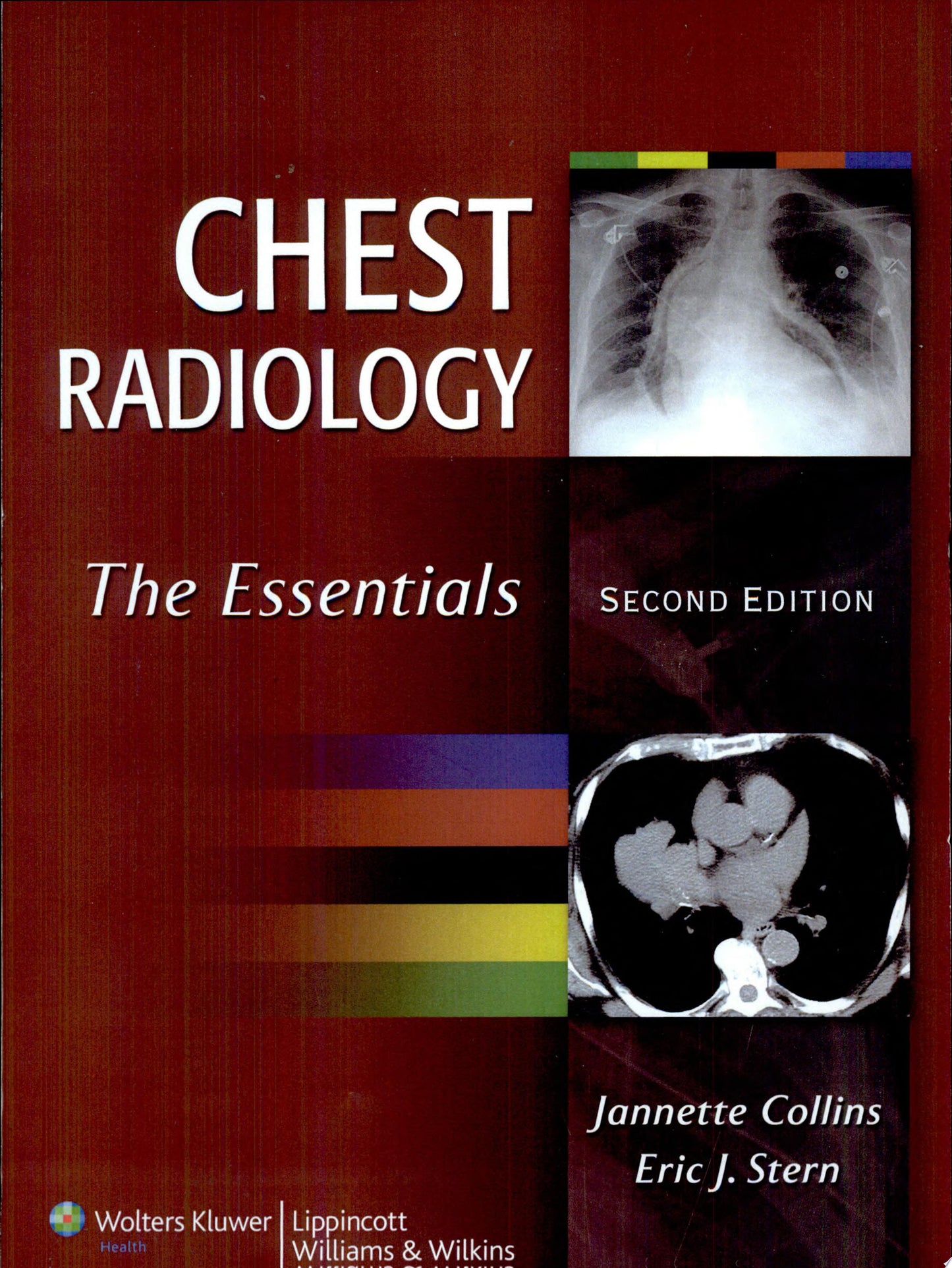 Chest Radiology: The Essentials, 2nd Edition