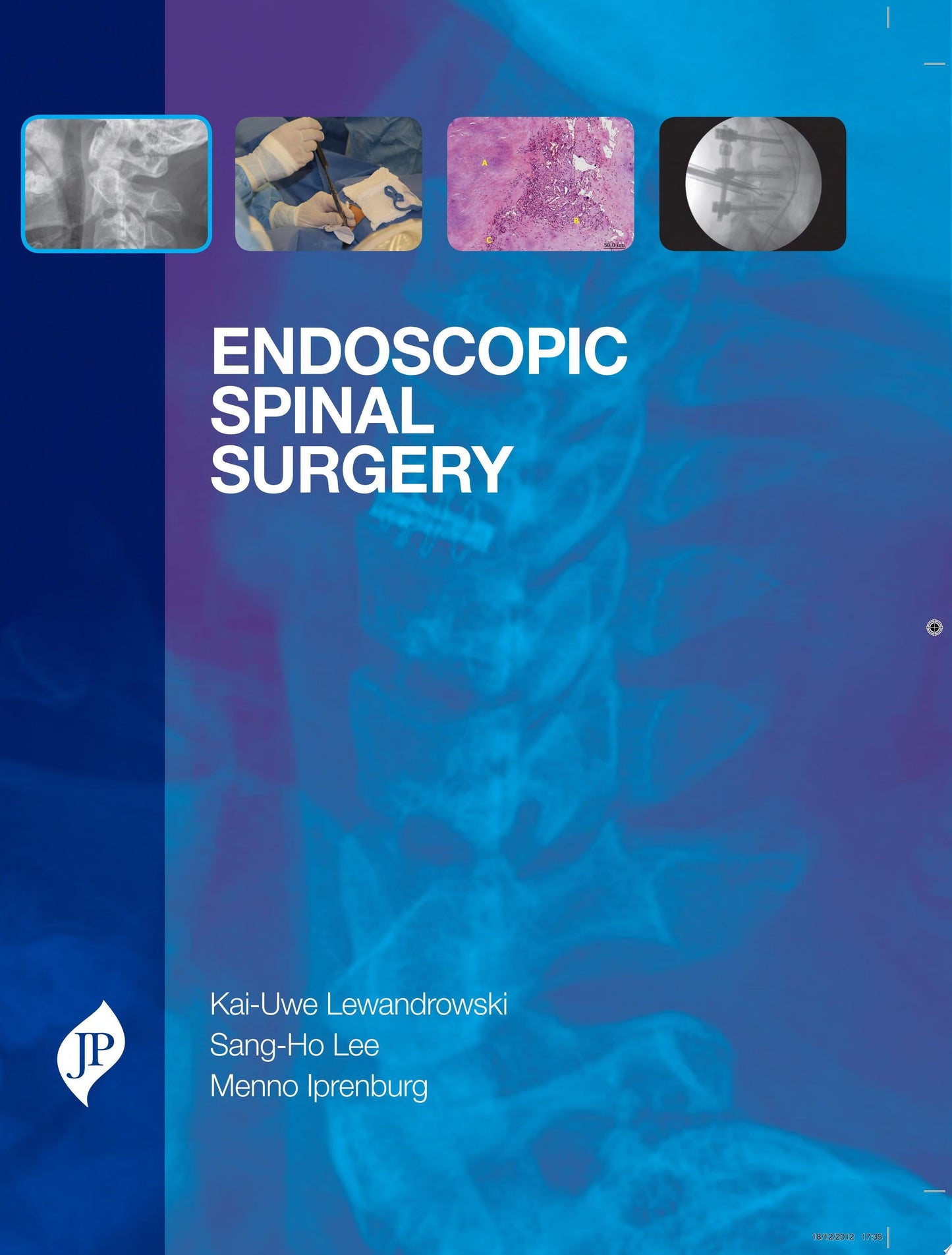 50 Landmark Papers Every Spine Surgeon Should Know (PDF)