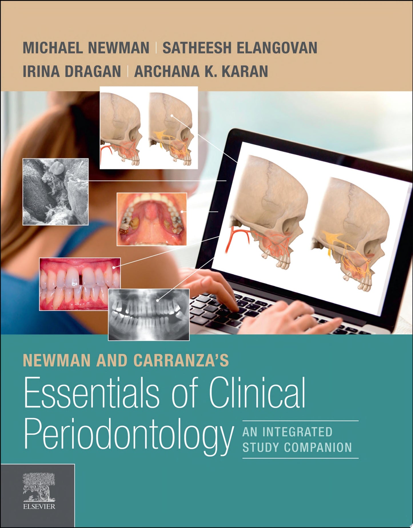 Newman and Carranza's Essentials of Clinical Periodontology E-Book