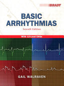 Basic Arrhythmias