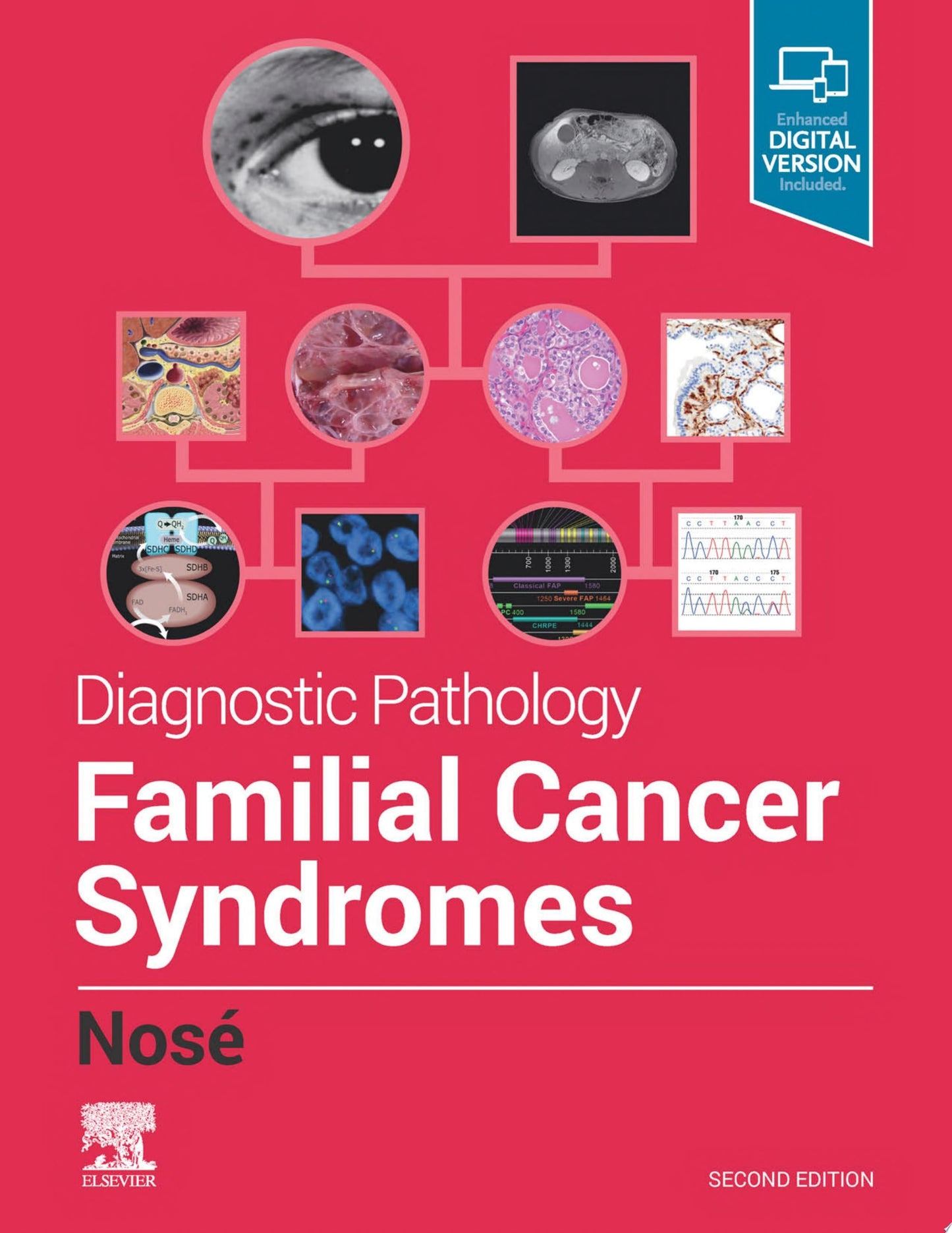Diagnostic Pathology: Familial Cancer Syndromes, 2nd Edition