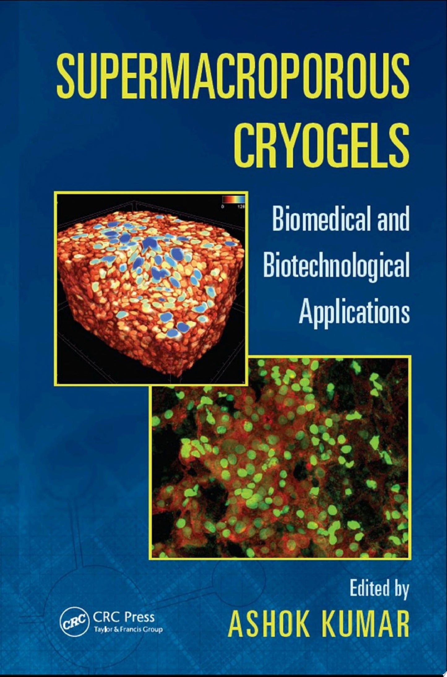 Supermacroporous Cryogels: Biomedical and Biotechnological Applications