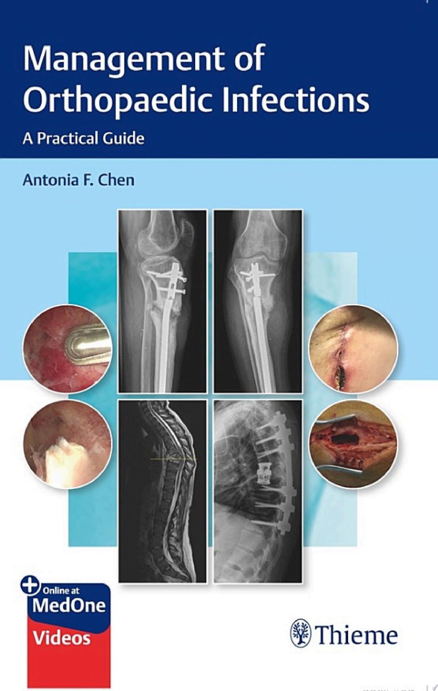 Management of Orthopaedic Infections: A Practical Guide
