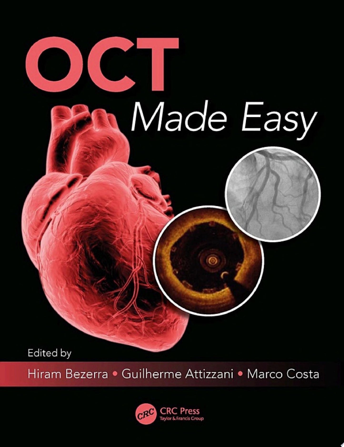 IVUS Made Easy 2e
