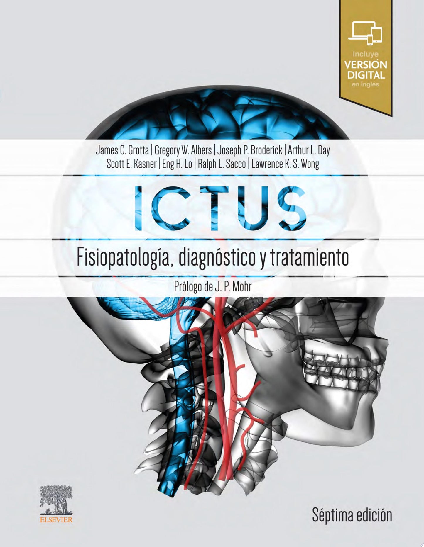 Ictus: Fisiopatología, diagnóstico y abordaje: Patofisiología, diagnóstico y manejo, 7th Edition