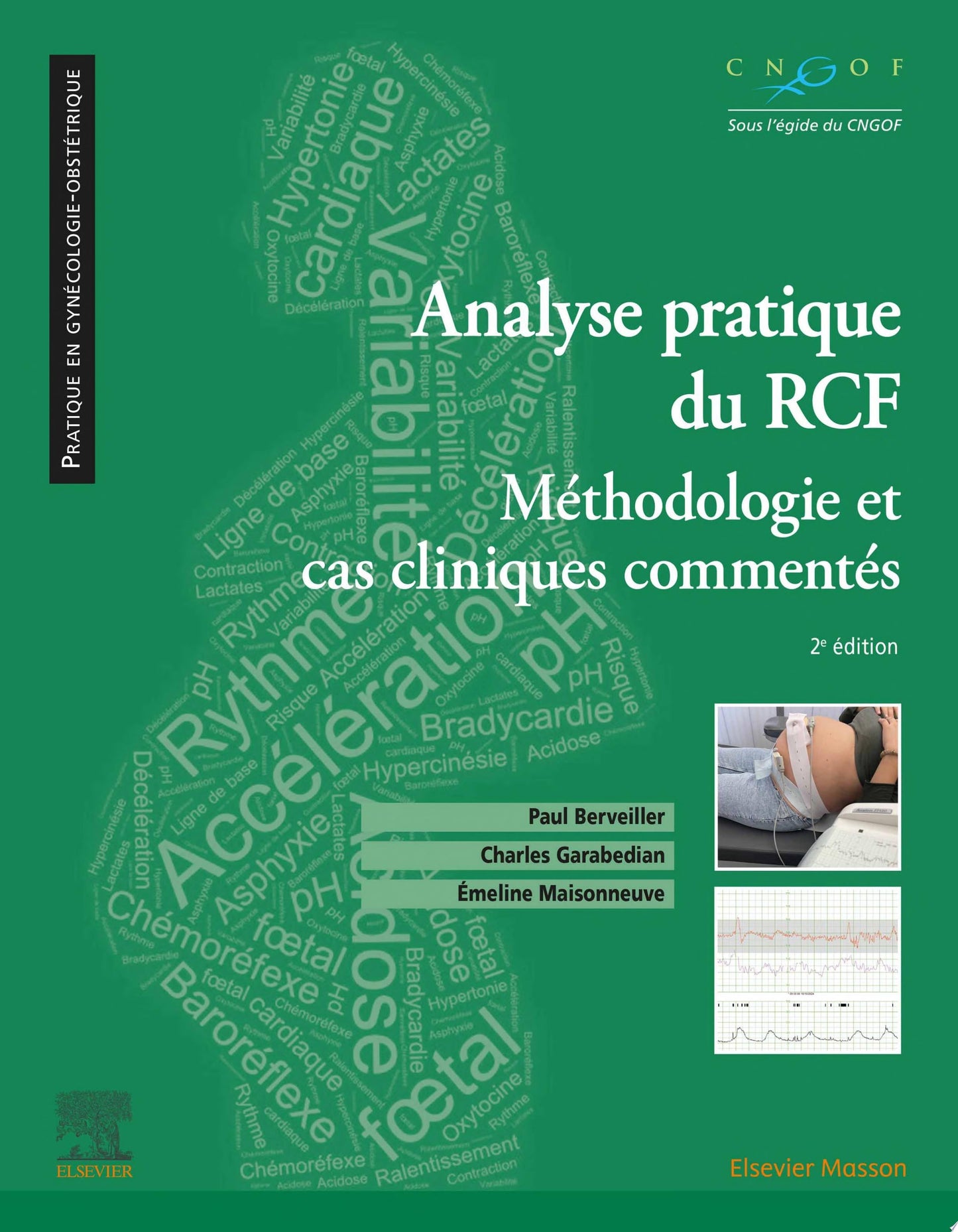 Analyse pratique du RCF: Rythme cardiaque foetal, 2nd Edition