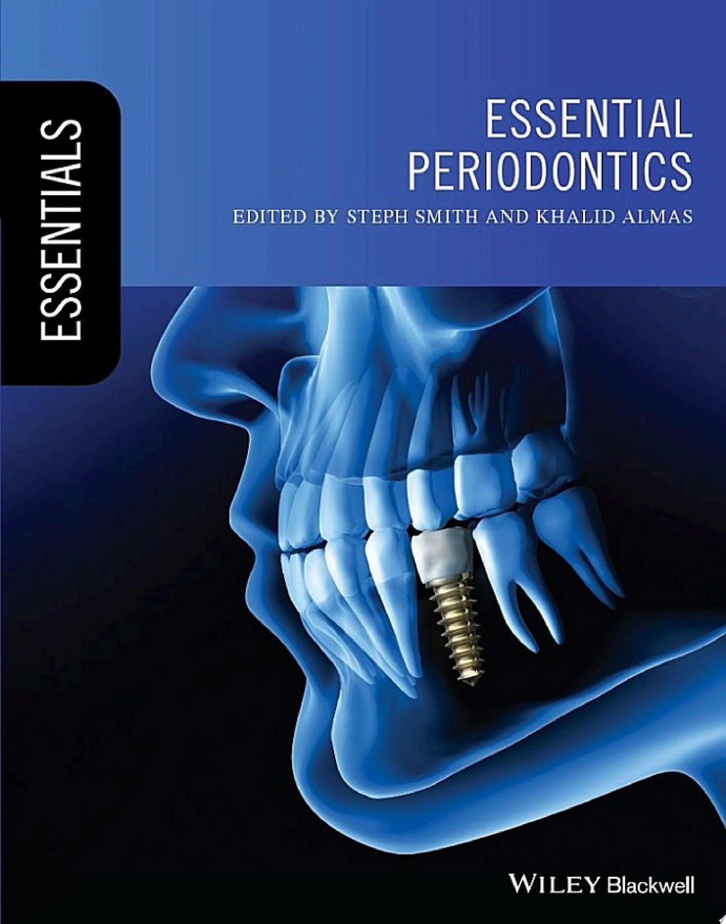 Essential Periodontics