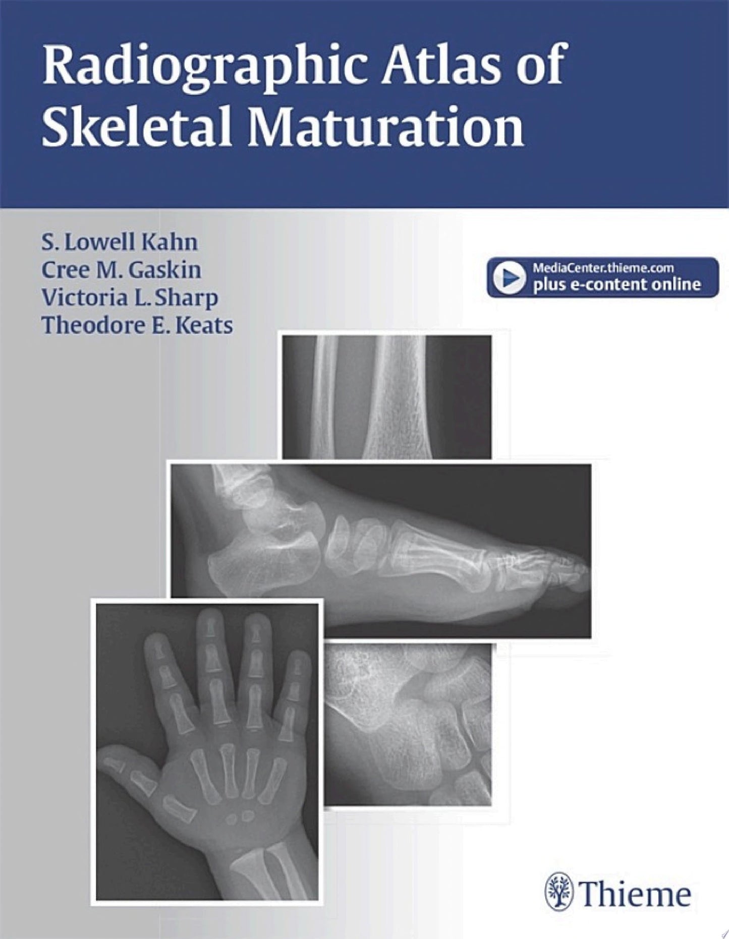 Radiographic Atlas of Skeletal Maturation (ORIGINAL PDF from Publisher)