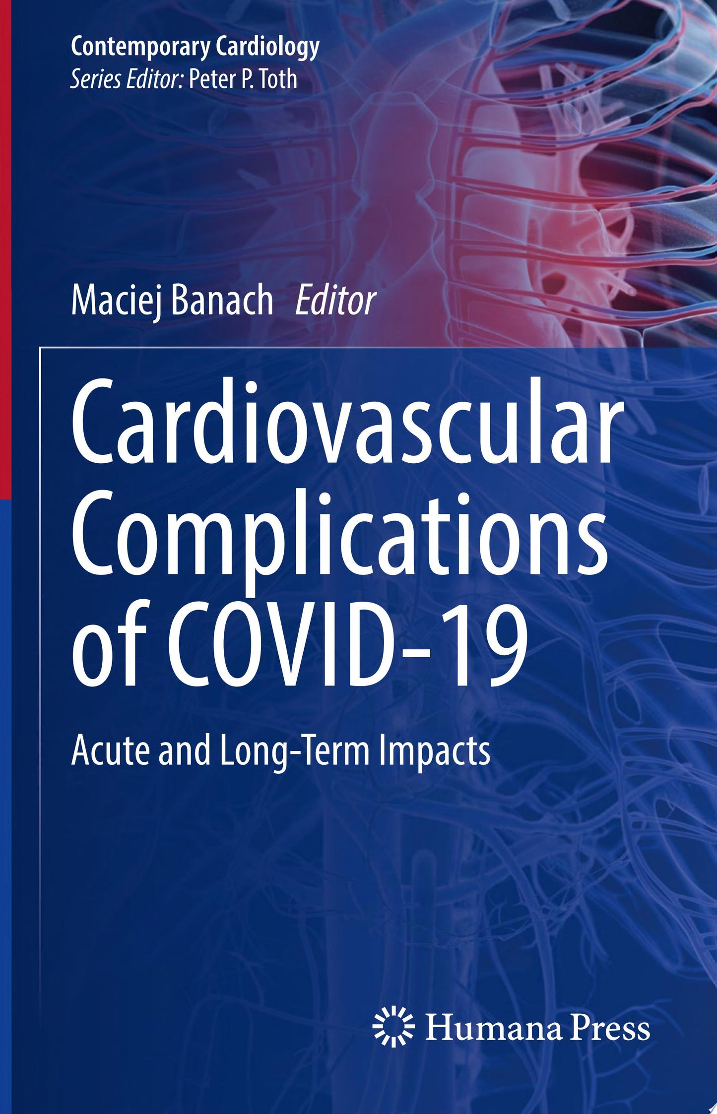 Cardiovascular Complications of COVID-19