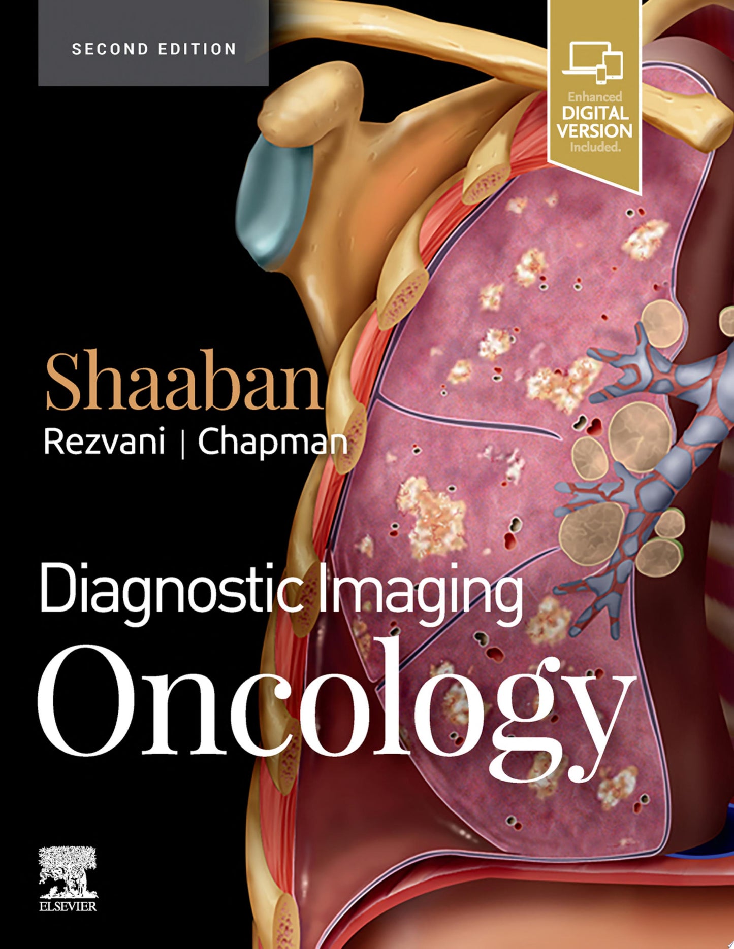 Diagnostic Imaging: Oncology, 2nd Edition