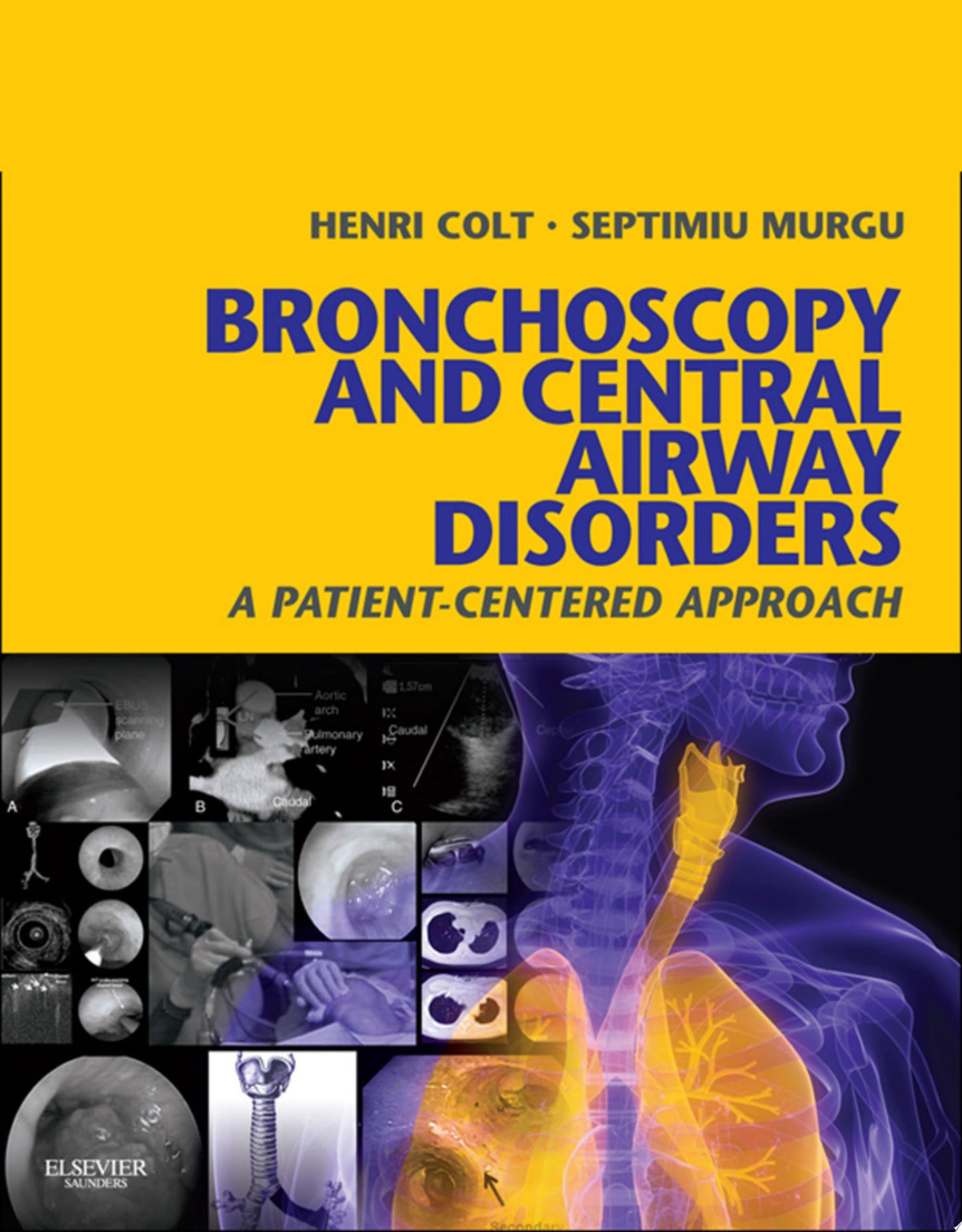 Bronchoscopy and Central Airway Disorders: A Patient-Centered Approach
