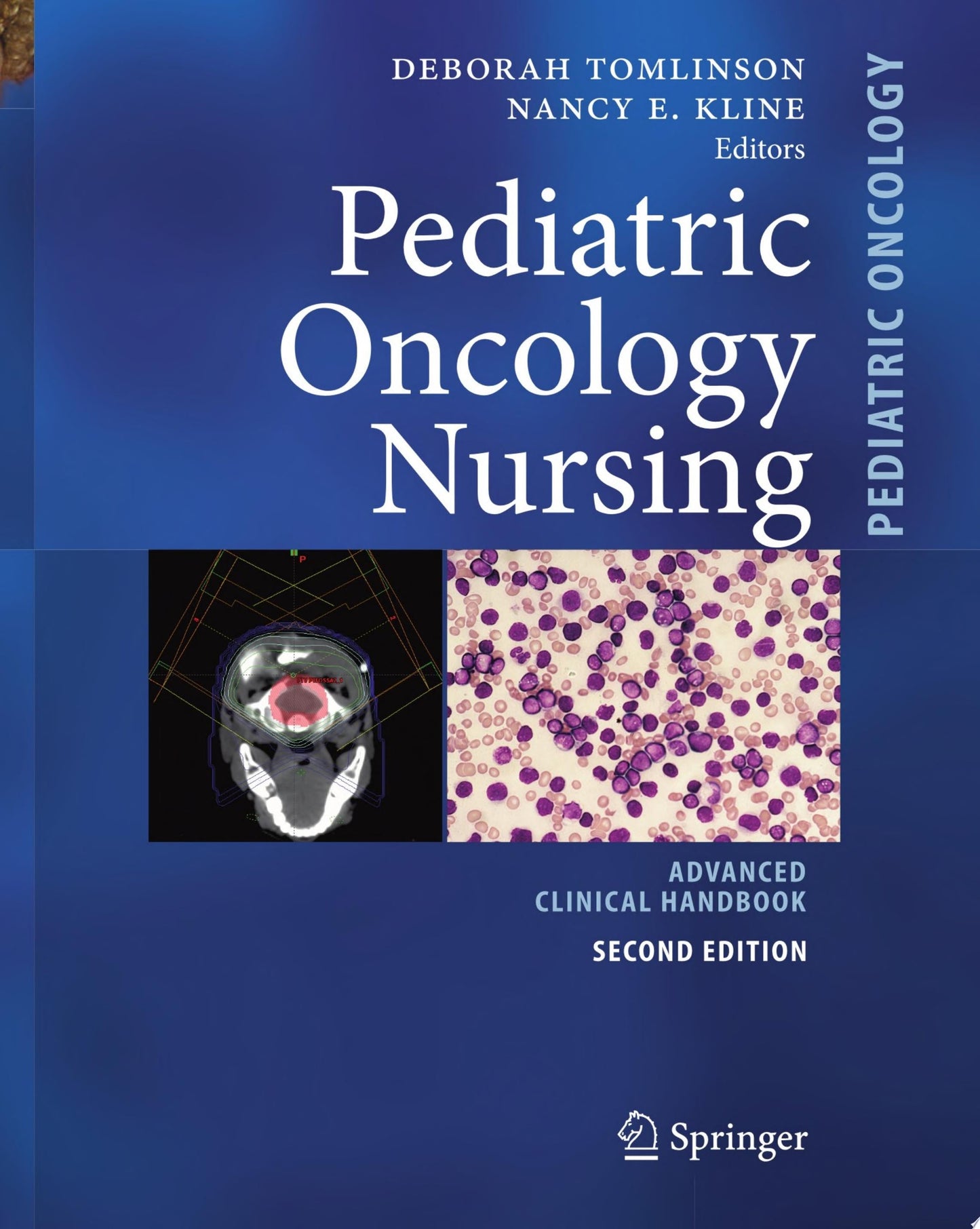 Principles and Practice of Pediatric Oncology, 6th