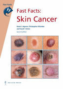 Fast Facts: Skin Cancer, 2nd Edition
