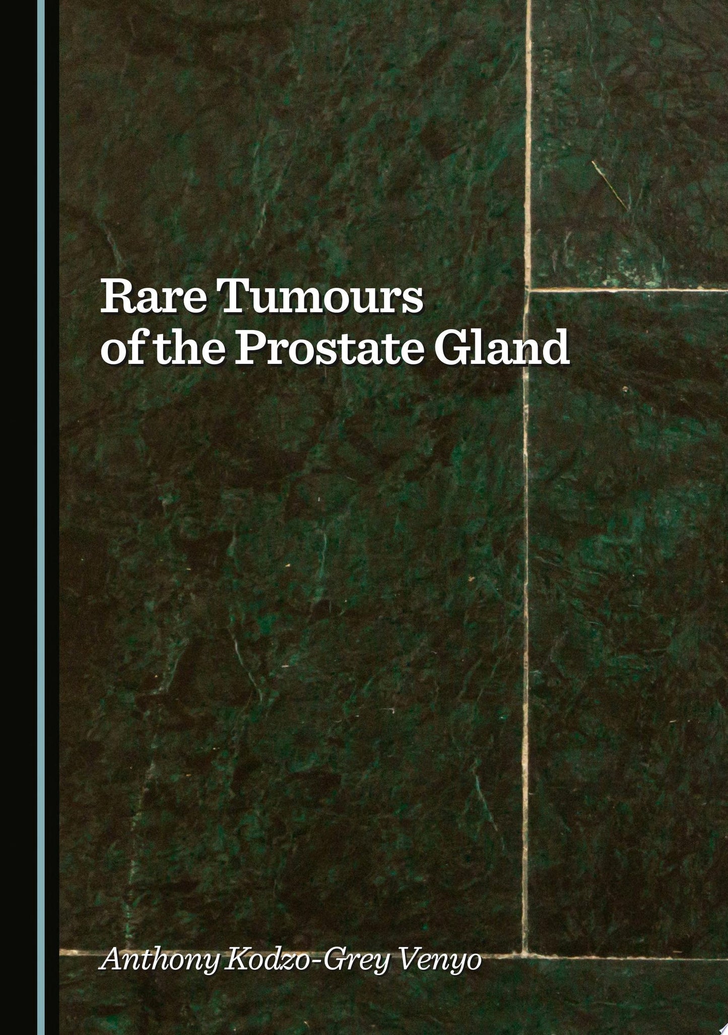 Rare Tumours of the Prostate Gland
