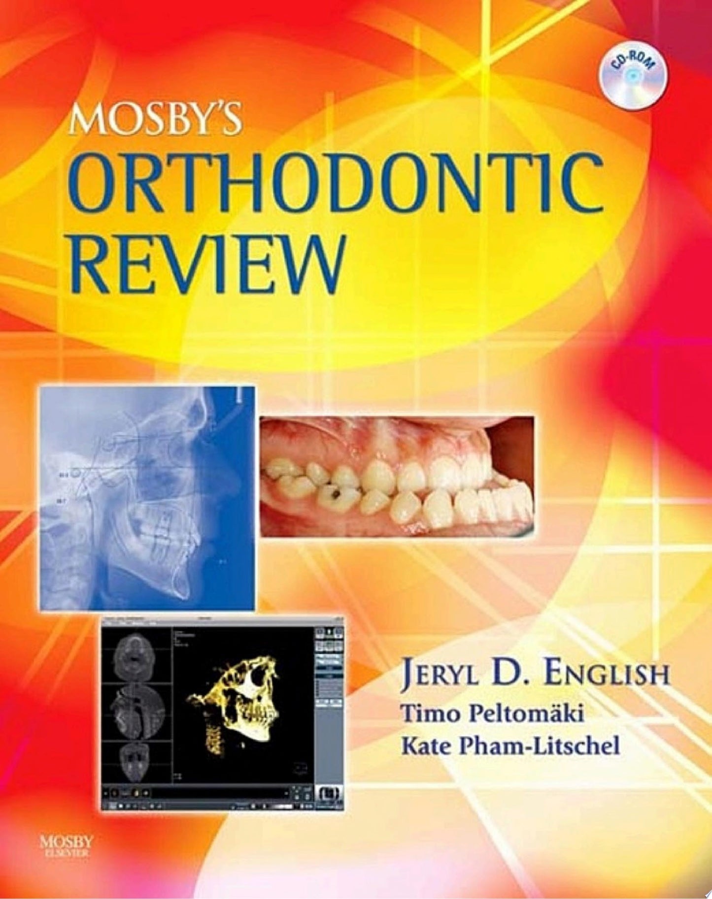 Mosby's Orthodontic Review - E-Book
