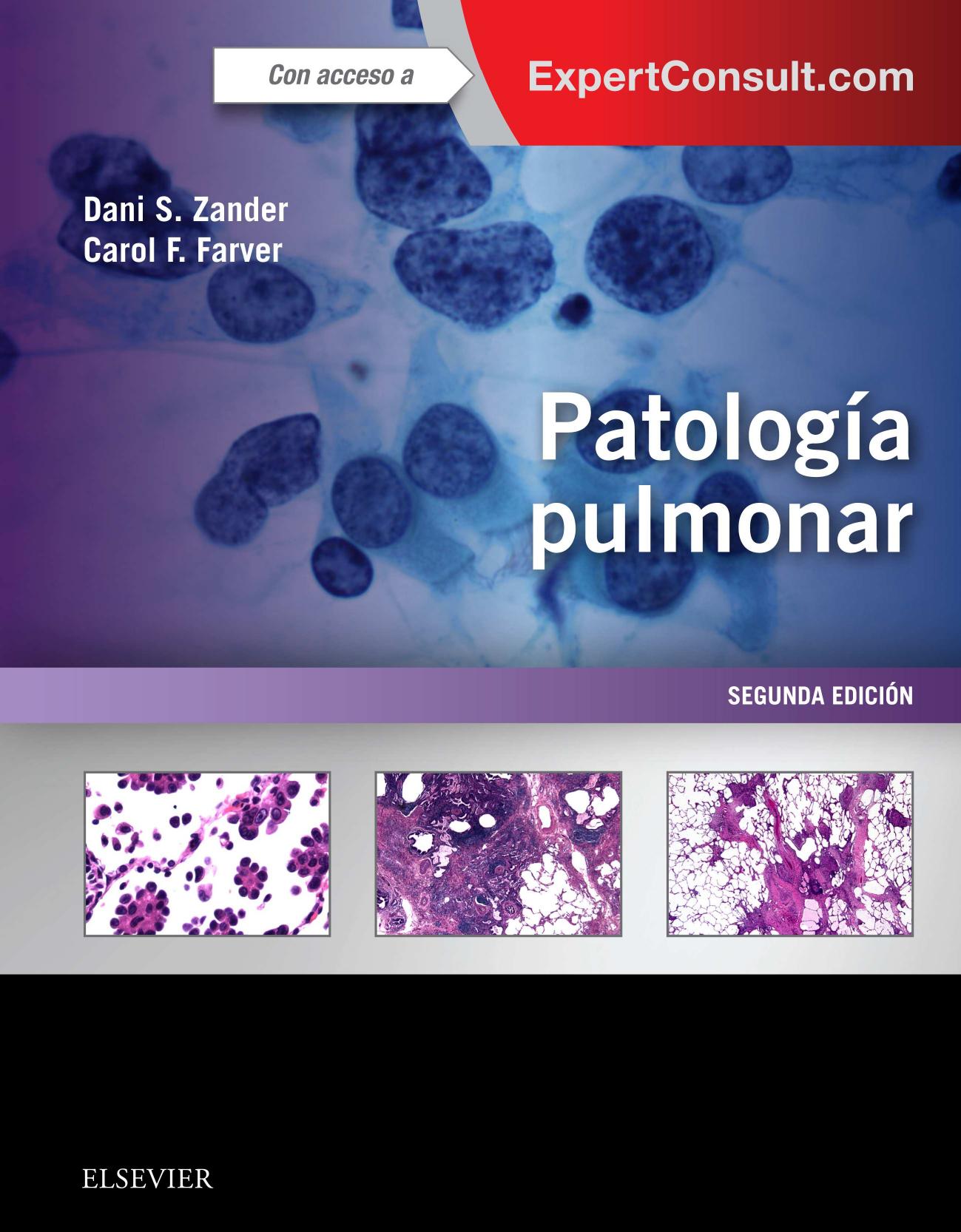Patología pulmonar + ExpertConsult (Spanish Edition) (PDF)