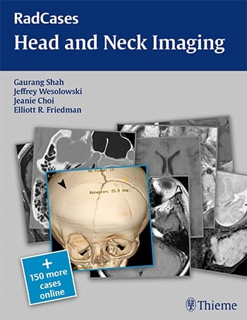 Head and Neck Imaging (RadCases)