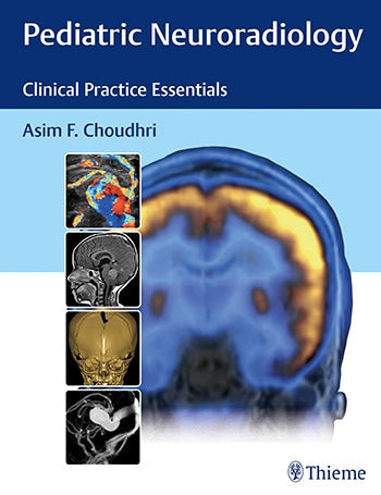 Pediatric Neuroradiology: The Essentials
