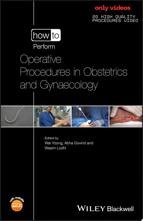 How to Perform Operative Procedures in Obstetrics and Gynaecology (PDF + Videos)