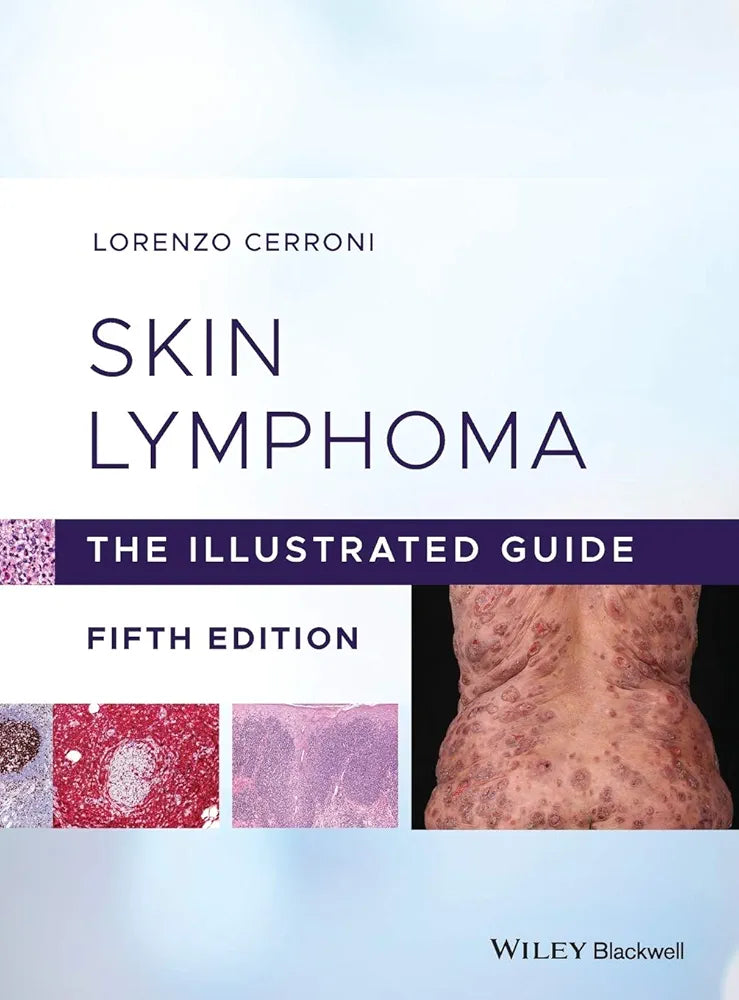 Skin Lymphoma: The Illustrated Guide, 5th Edition