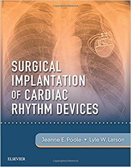Surgical Implantation of Cardiac Rhythm Devices, 1e