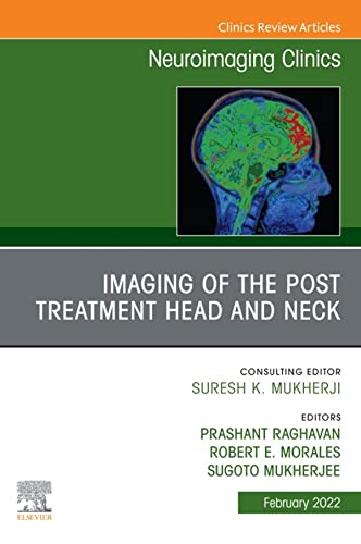 Imaging of the Post Treatment Head and Neck, An Issue of Neuroimaging Clinics of North America, E-Book (Clinics Collections)
