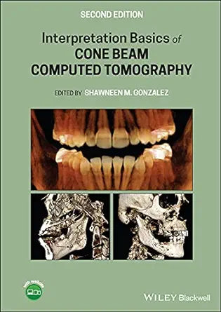 Interpretation Basics of Cone Beam Computed Tomography, 2nd Edition