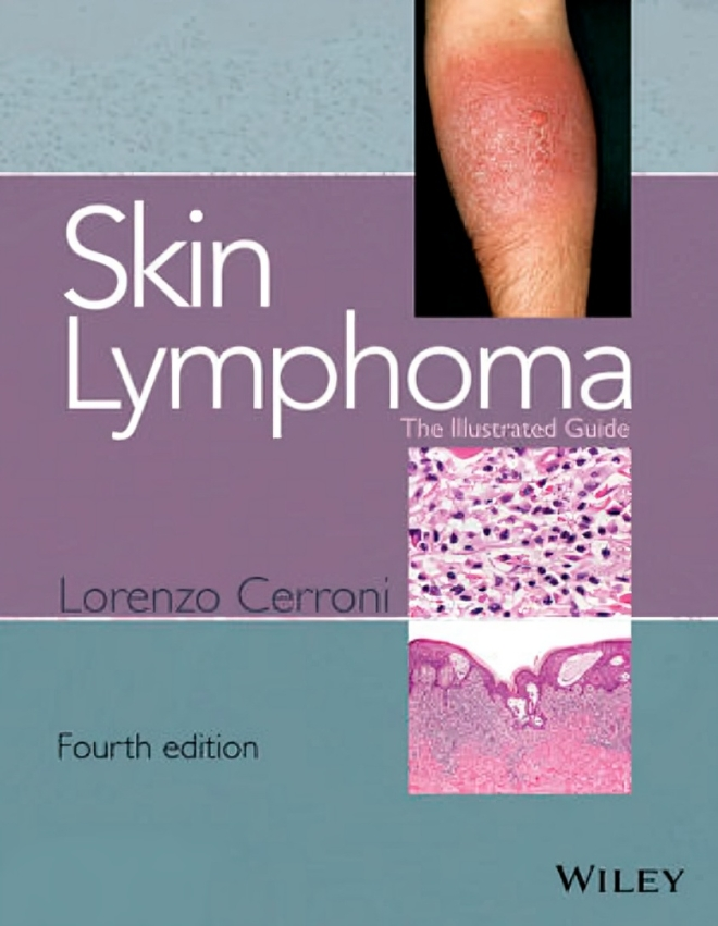 Skin Lymphoma: The Illustrated Guide, 4th Edition