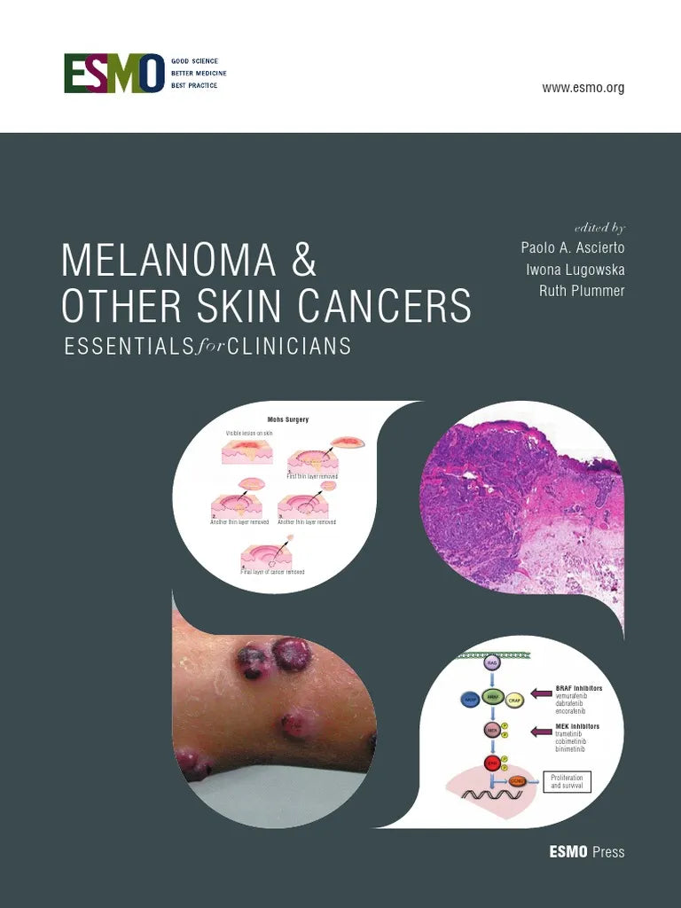 ESMO Melanoma & Other Skin Cancers: Essentials for Clinicians