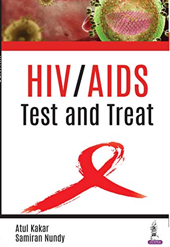 HIV/AIDS: Test and Treat