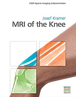 MRI of the Knee, 1st edition