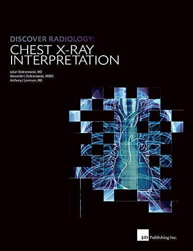Discover Radiology Chest X-Ray Interpretation : Book for Medical Student