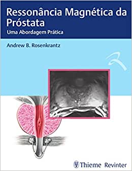 Ressonância Magnética da Próstata: Uma abordagem Prática