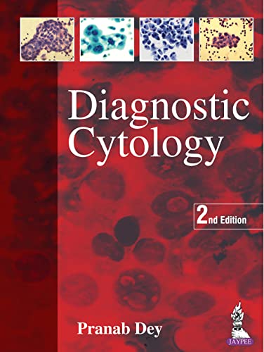 Diagnostic Cytology, 2nd Edition