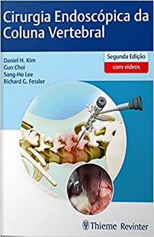 Cirurgia Endoscópica da Coluna Vertebral, 2nd Edition