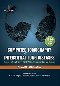 Computed Tomography of Interstitial Lung Diseases
