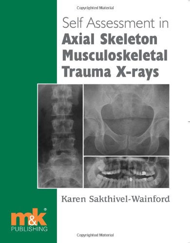 Self-assessment in Axial Skeleton Musculoskeletal Trauma X-rays