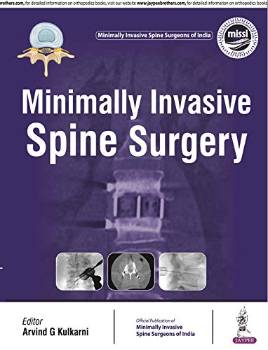 Minimally Invasive Spine Surgery (ORIGINAL PDF from Publisher)