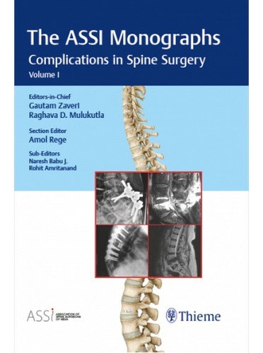 The ASSI Monographs: Ankylosing Spondylitis
