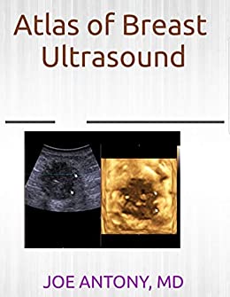 Atlas of breast ultrasound