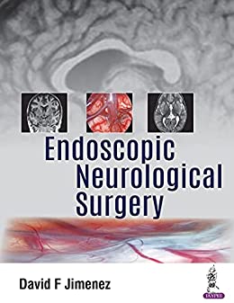 Endoscopic Neurological Surgery