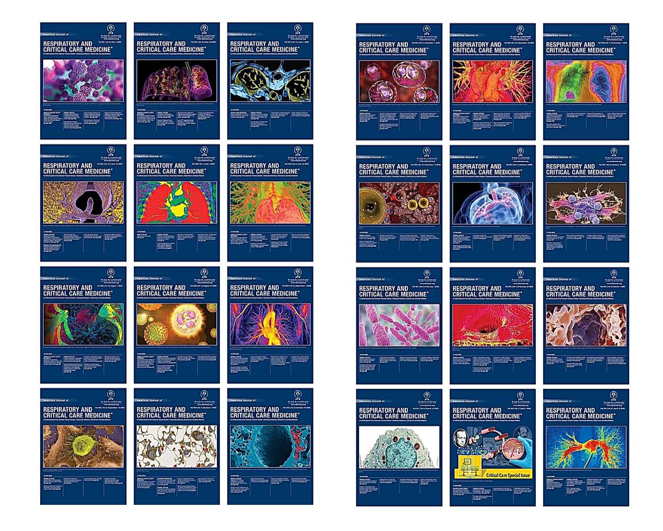 American Journal of Respiratory and Critical Care Medicine 2020 Full Archives (True PDF)