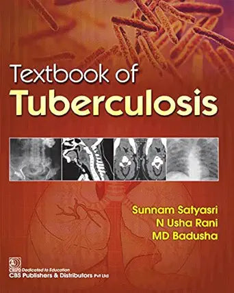 Textbook of Tuberculosis