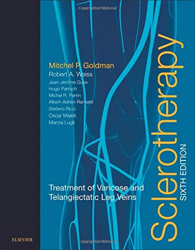 Sclerotherapy: Treatment of Varicose and Telangiectatic Leg Veins, 6th Edition