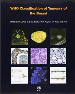 WHO Classification of Tumours of the Breast (IARC WHO Classification of Tumours) (Retail PDF)