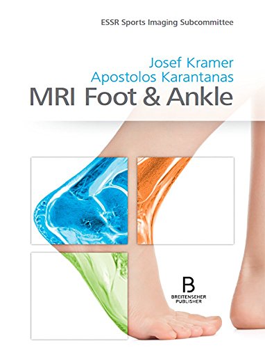 MRI Foot & Ankle