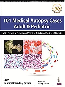 101 Medical Autopsy Cases: Adult & Pediatric With Complete Pathological/Clinical Details and Review of Literature