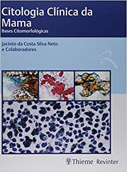 Citologia Clínica da Mama: Bases Citomorfológicas