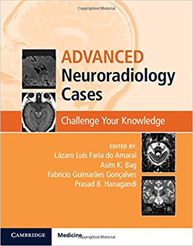 Advanced Neuroradiology Cases: Challenge Your Knowledge, 1e  (ORIGINAL PDF from Publisher)