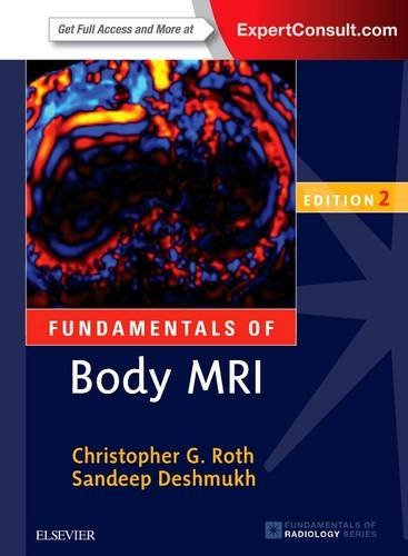 Fundamentals of Body MRI, 2nd Edition (Fundamentals of Radiology) (Retail PDF)